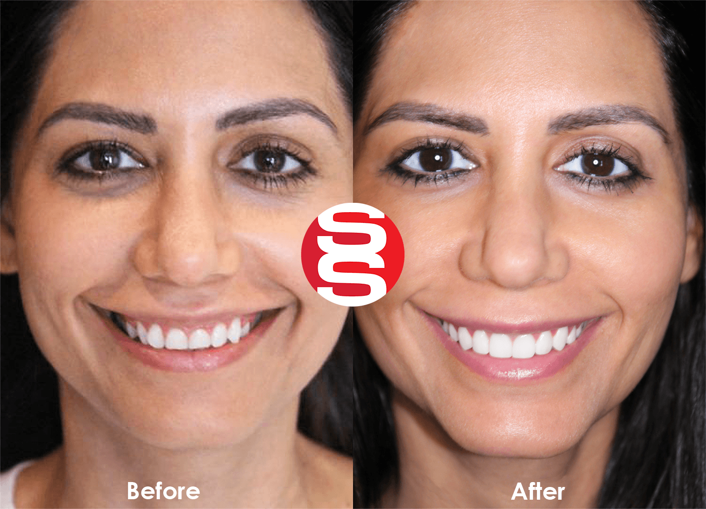 Ashley Before - After
