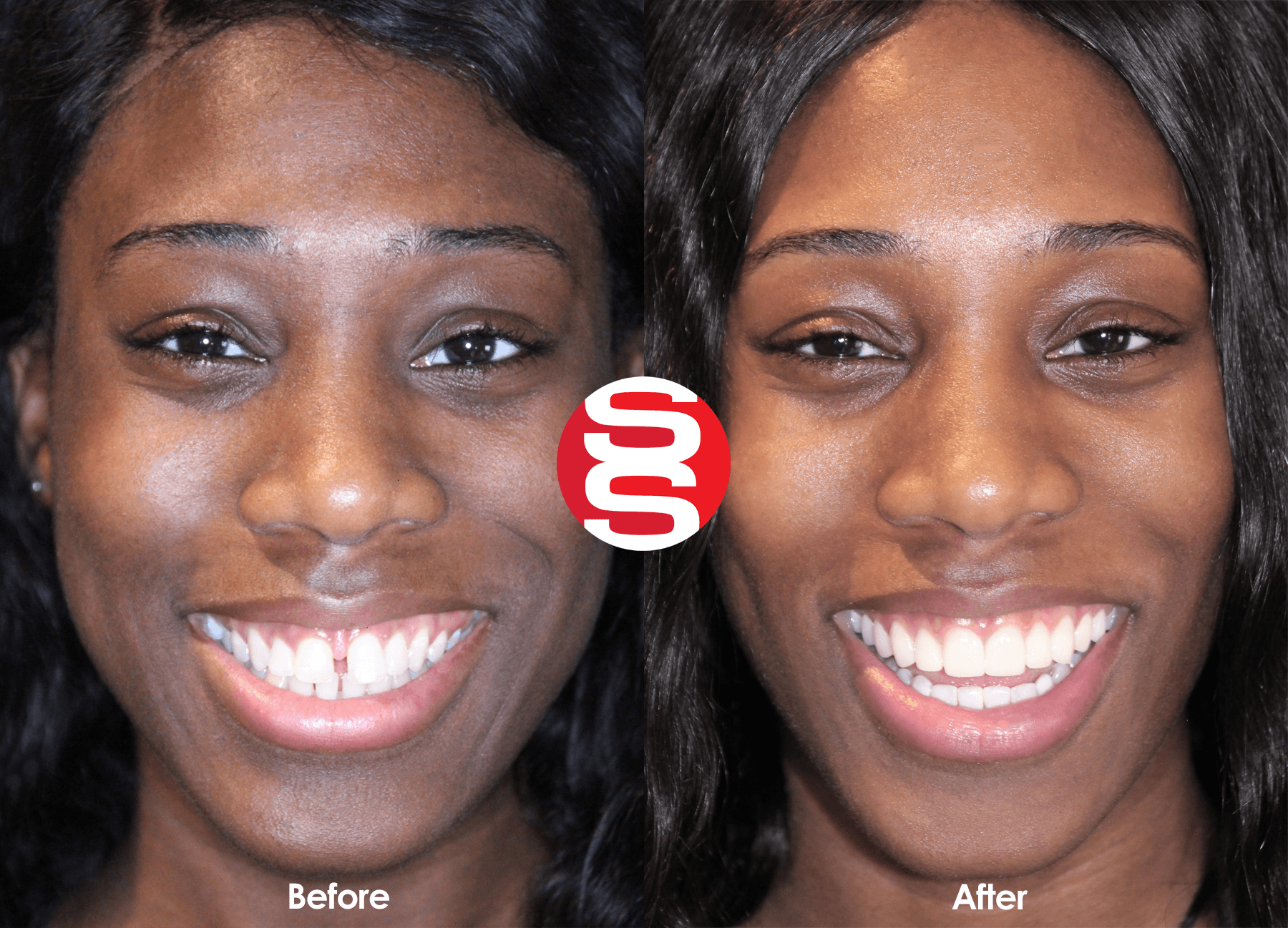 Ashley Before - After