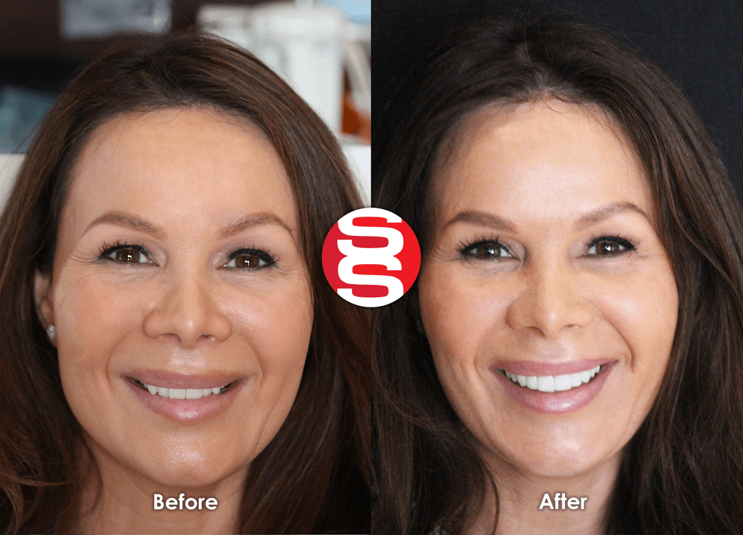 Ashley Before - After