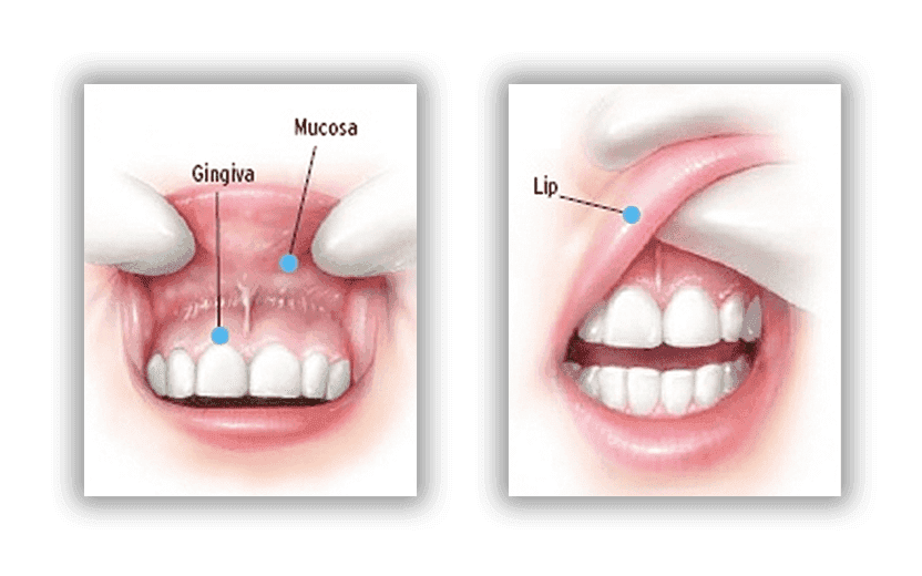Lip Area