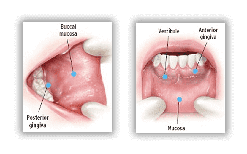 Mucosa