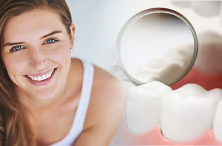 All Ceramic Crowns