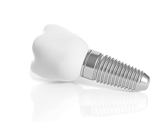 Dental Implant Treatment