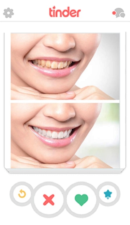 Smile Makover