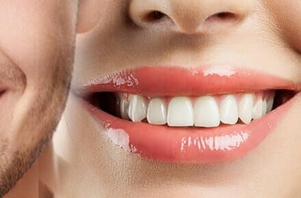 Full Mouth Reconstruction