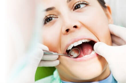 White Fillings